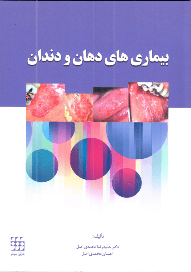 بیماری های دهان و دندان