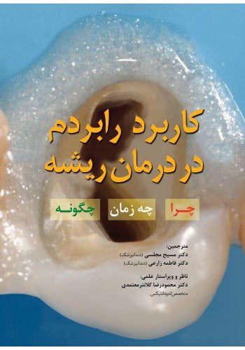 کاربرد رابردم در درمان ریشه چرا - چه زمان - چگونه
