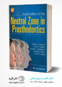 Application Of The Neutral Zone In Prosthodontics