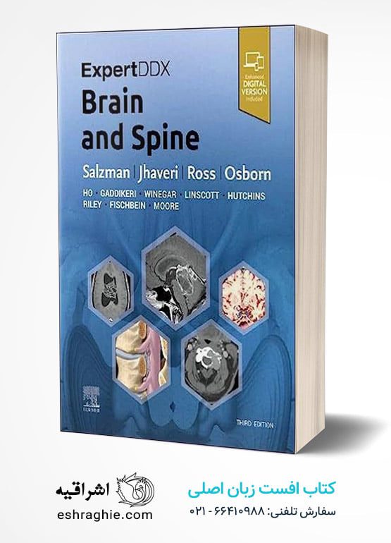 ExpertDDx: Brain and Spine 3rd Edition