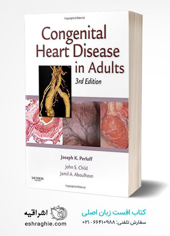 Congenital Heart Disease in Adults, 3rd Edition
