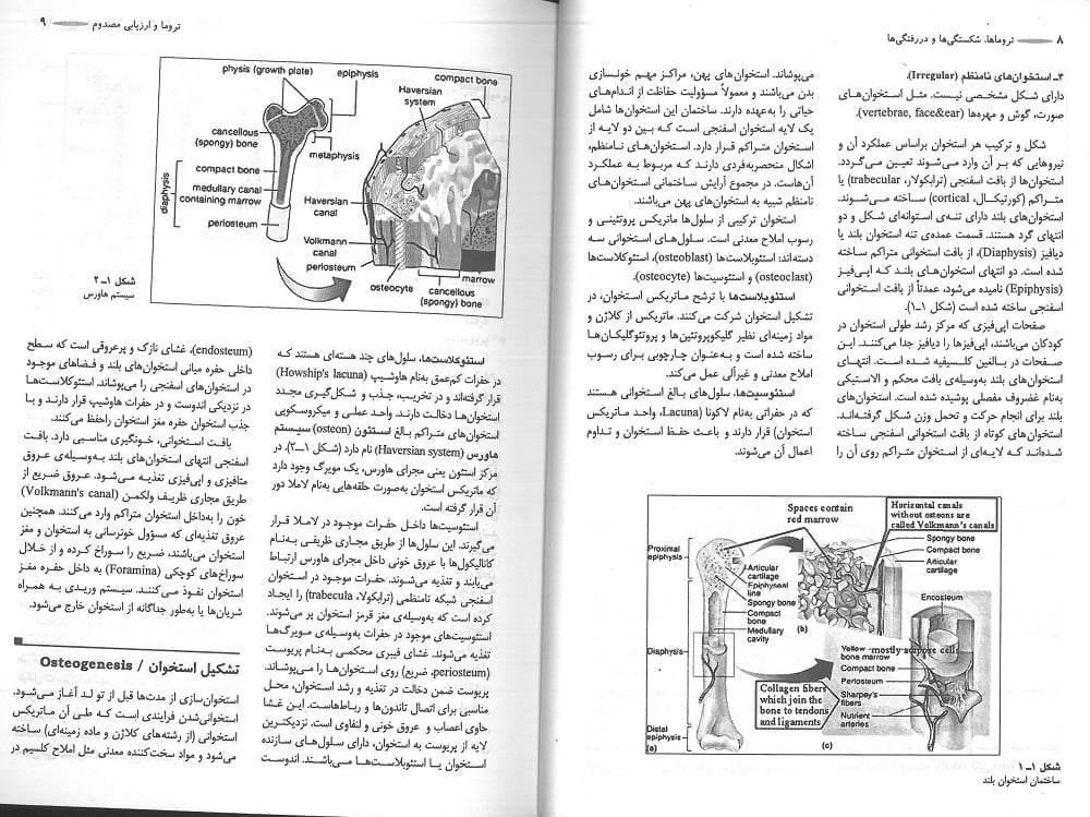 تروماها، شکستگی ها و دررفتگی ها - Image 5