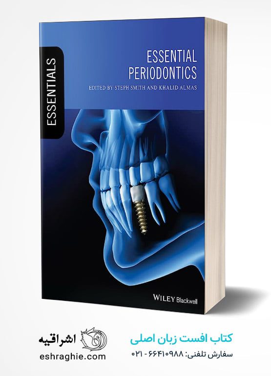Essential Periodontics