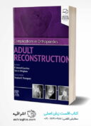 Complications In Orthopaedics: Adult Reconstruction