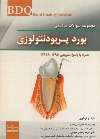 سوالات تفکیکی بورد پریو