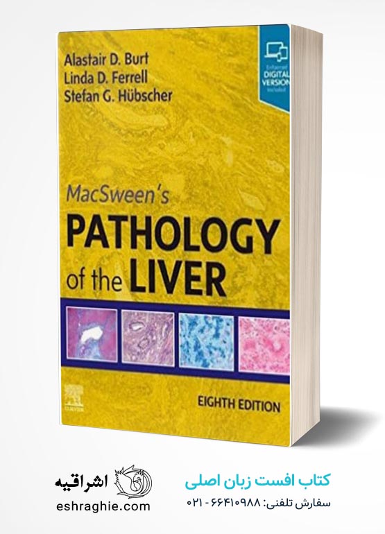 MacSween’s Pathology of the Liver 8th Edition