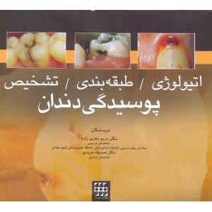 اتیولوژی/طبقه بندی/تشخیص پوسیدگی دندان