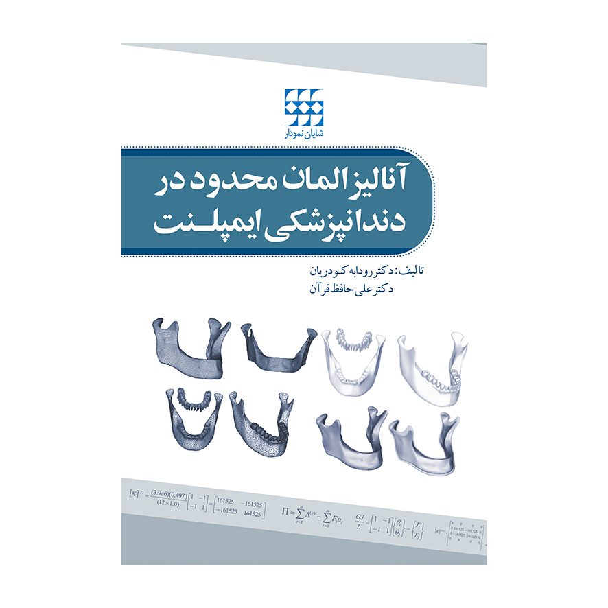 آنالیز المان محدود در دندانپزشکی ایمپلنت