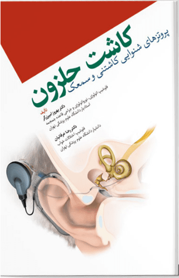 کاشت حلزون