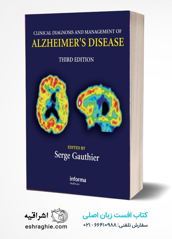 Clinical Diagnosis and Management of Alzheimer's Disease