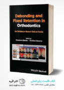 Debonding And Fixed Retention In Orthodontics: An Evidence-Based Clinical Guide