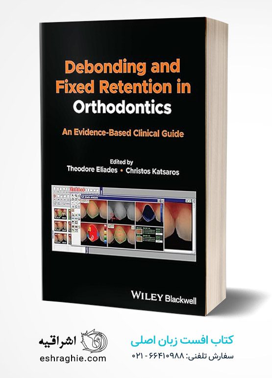 Debonding and Fixed Retention in Orthodontics: An Evidence-Based Clinical Guide