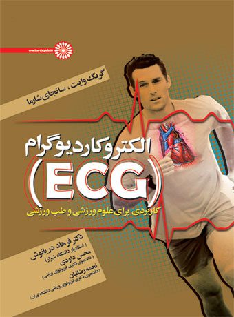 الکتروکاردیوگرام (ECG)