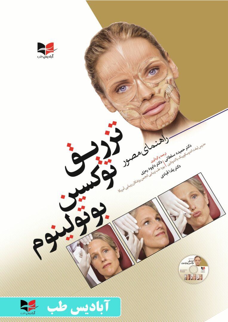 راهنمای مصور تزریق توکسین بوتولینوم
