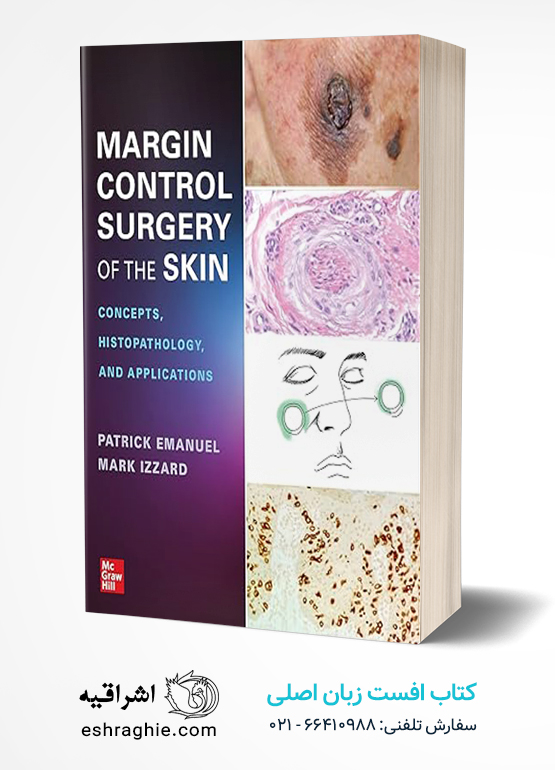 Margin Control Surgery of the Skin