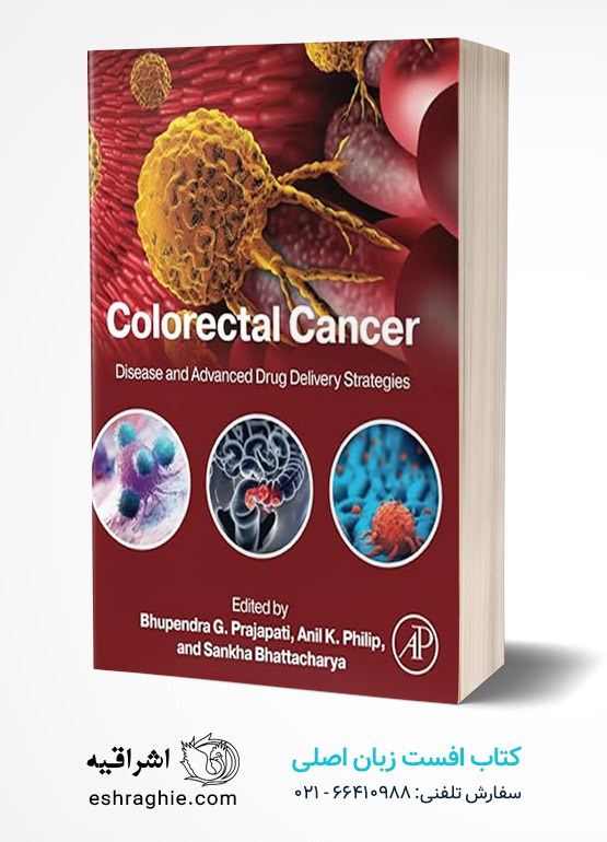 Colorectal Cancer: Disease and Advanced Drug Delivery Strategies