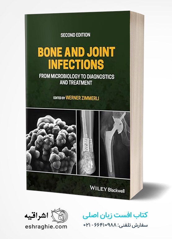 Bone and Joint Infections: From Microbiology to Diagnostics and Treatment ...
