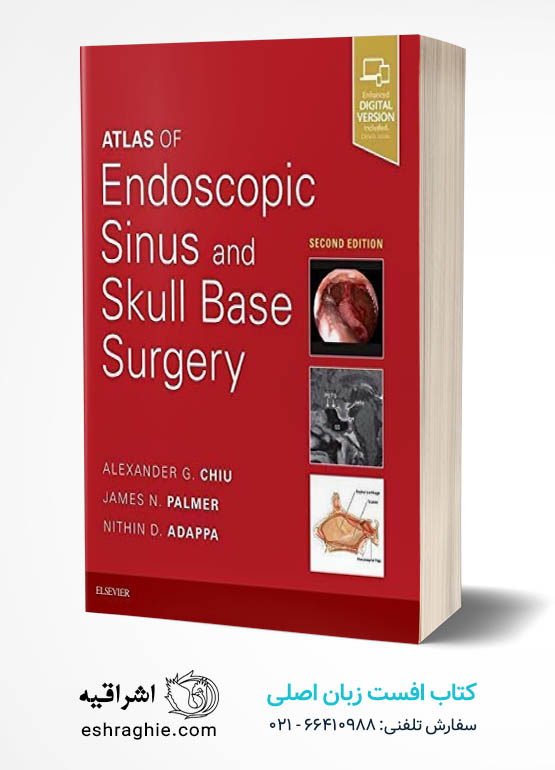 Atlas of Endoscopic Sinus and Skull Base Surgery 2nd Edition