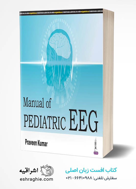 Manual of Pediatric EEG