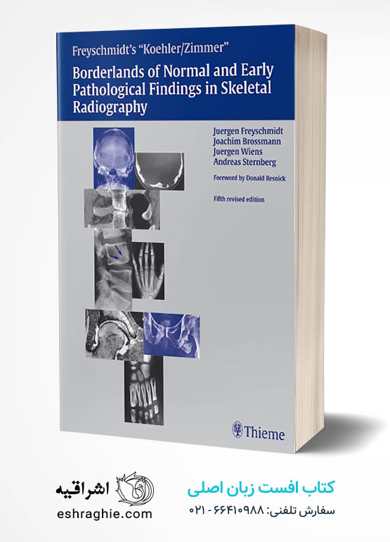 Freyschmidt's "Koehler/Zimmer" Borderlands of Normal and Early Pathological Findings in Skeletal Radiography 5th Edition