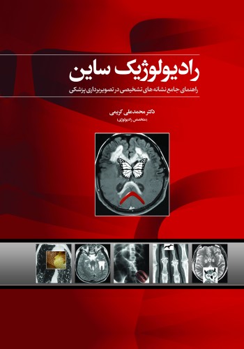 کتاب رادیولوژیک ساین (راهنمای جامع تکنیک های تشخیصی در تصویربرداری پزشکی) نویسنده : دکتر محمد علی کریمی