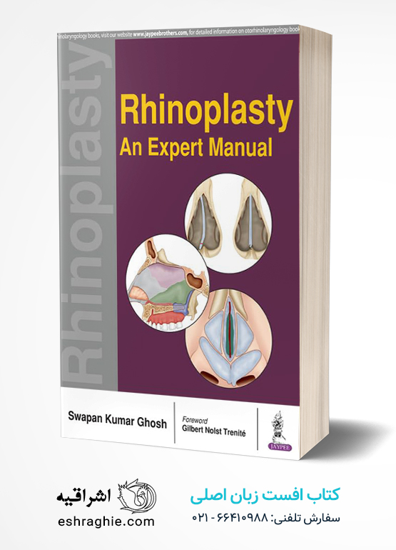 Rhinoplasty: An Expert Manual 1st Edition