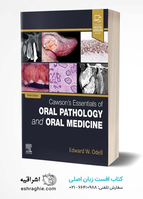 Cawson's Essentials of Oral Pathology and Oral Medicine 10th Edition