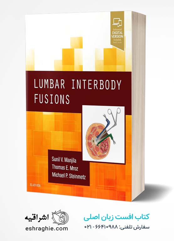 Lumbar Interbody Fusions 1st Edition