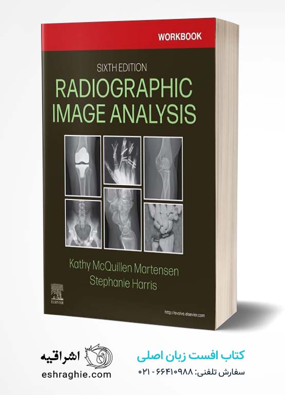 Workbook for Radiographic Image Analysis 6th Edition کتاب افست زبان اصلی حل تمرین آنالیز تصویر های رادیوگرافی - ویرایش ششم 2024