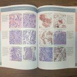 Diagnostic Pathology: Gastrointestinal 4th Edition