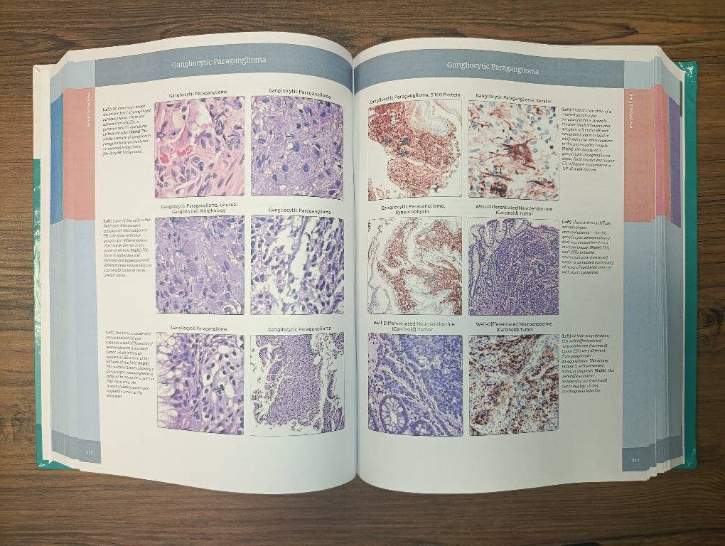 Diagnostic Pathology: Gastrointestinal 4th Edition