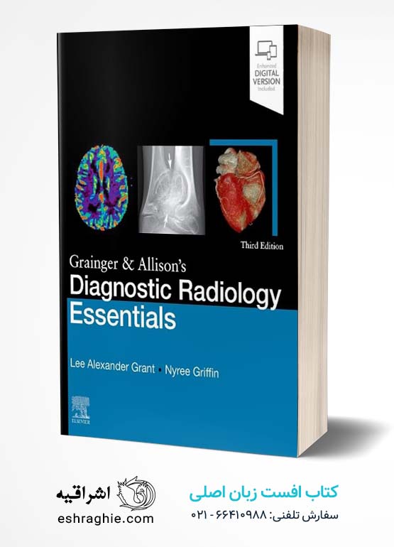 Grainger & Allison's Diagnostic Radiology Essentials 3rd Edition