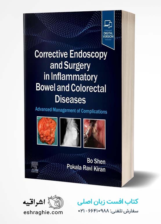 Corrective Endoscopy and Surgery in Inflammatory Bowel and Colorectal Diseases: Advanced Management of Complications