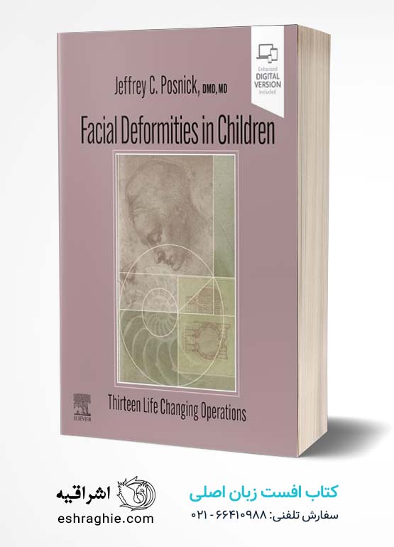 Facial Deformities in Children: Thirteen Life Changing Operations 1st Edition