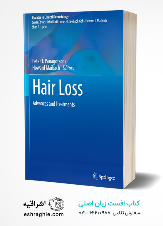 Hair Loss: Advances and Treatments (Updates in Clinical Dermatology)