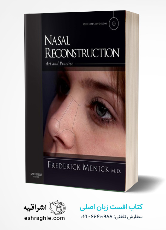 Nasal Reconstruction: Art and Practice 1st Edition کتاب افست زبان اصلی بازسازی بینی: هنر و عمل (ویراست اول)
