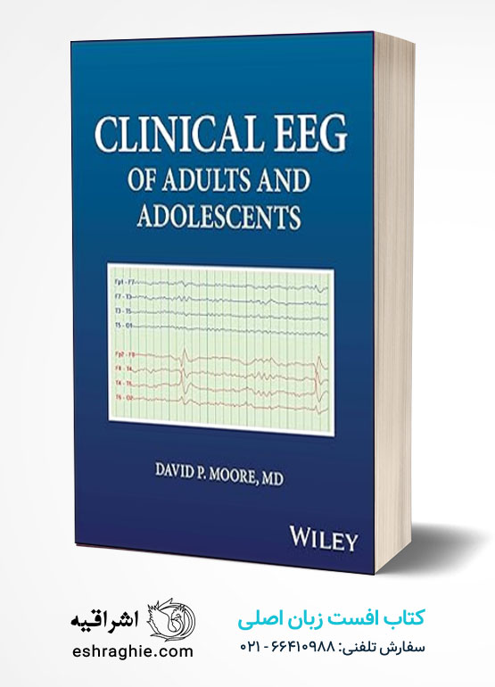 Clinical EEG of Adults and Adolescents 1st Edition کتاب افست زبان اصلی الکتروانسفاکوگرافی بالینی در بزرگسالان و نوجوانان | ویرایش اول