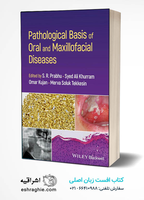 Pathological Basis of Oral and Maxillofacial Diseases کتاب افست زبان اصلی آسیب شناسی بیماری های دهان و فک و صورت