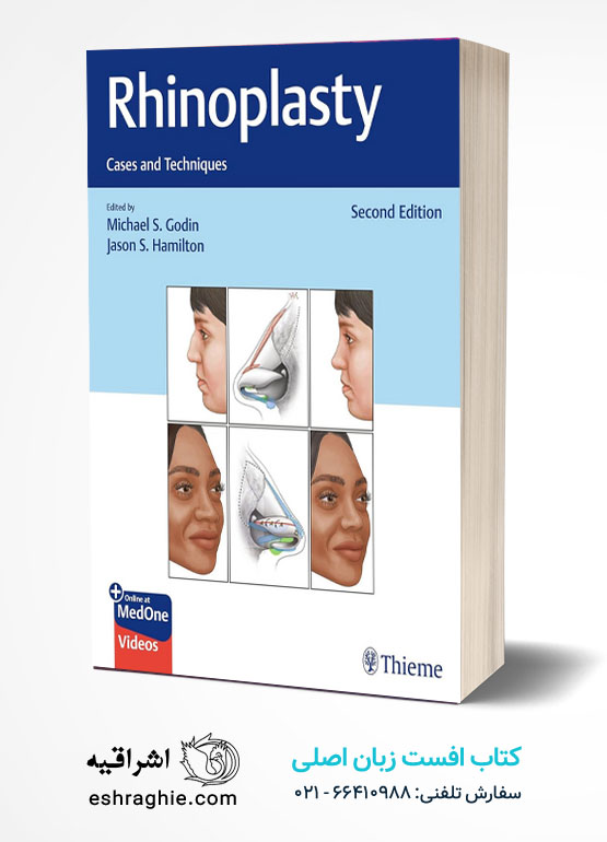 Rhinoplasty: Cases and Techniques 2nd Edition کتاب افست زبان اصلی راینوپلاستی - کیس ها و تکنیک ها - ویرایش دوم