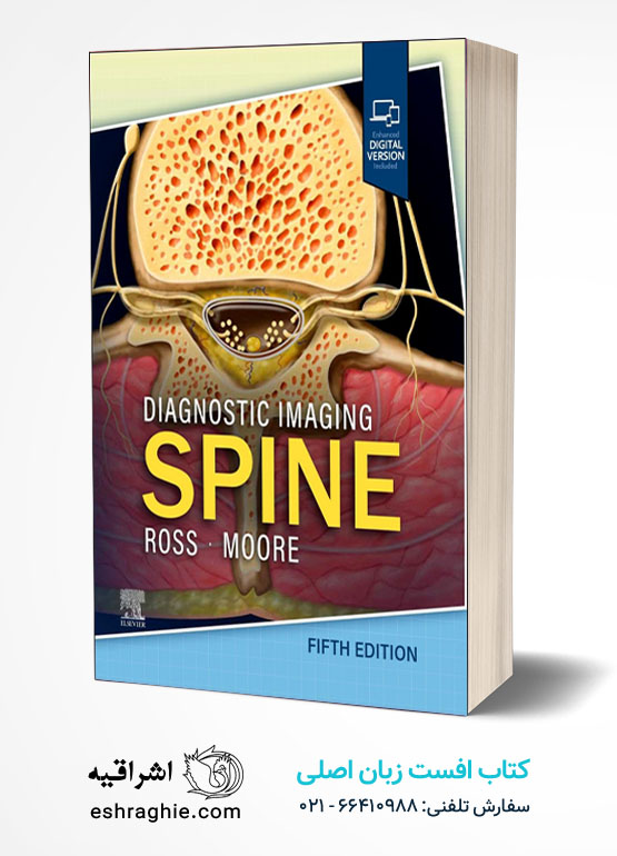 Diagnostic Imaging: Spine 5th Edition کتاب افست زبان اصلی تصویربرداری تشخیص ستون فقرات - ویرایش پنجم