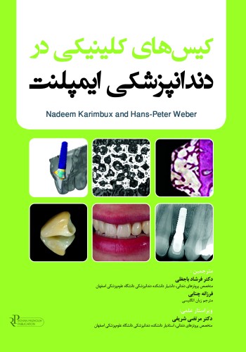 کیس های کلینیکی در دندانپزشکی ایمپلنت