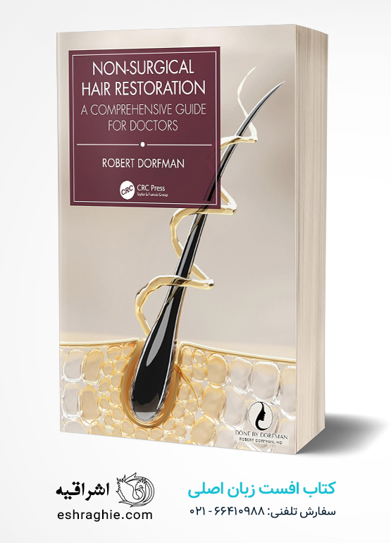 Non-Surgical Hair Restoration: A Comprehensive Guide for Doctors