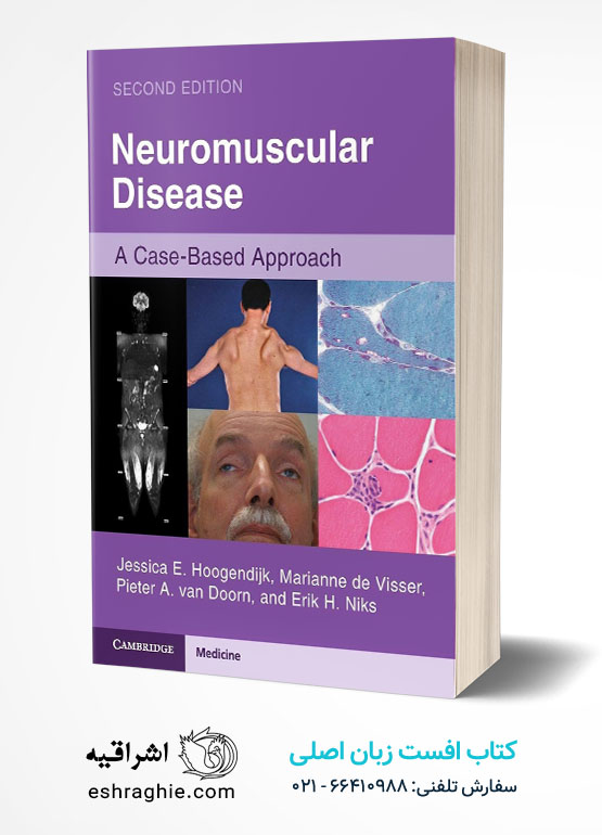 Neuromuscular Disease 2nd Edition