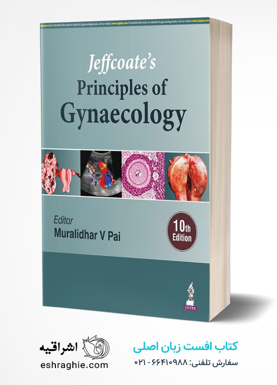Jeffcoate’s Principles of Gynaecology