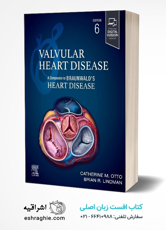 جلد کتاب Valvular Heart Disease